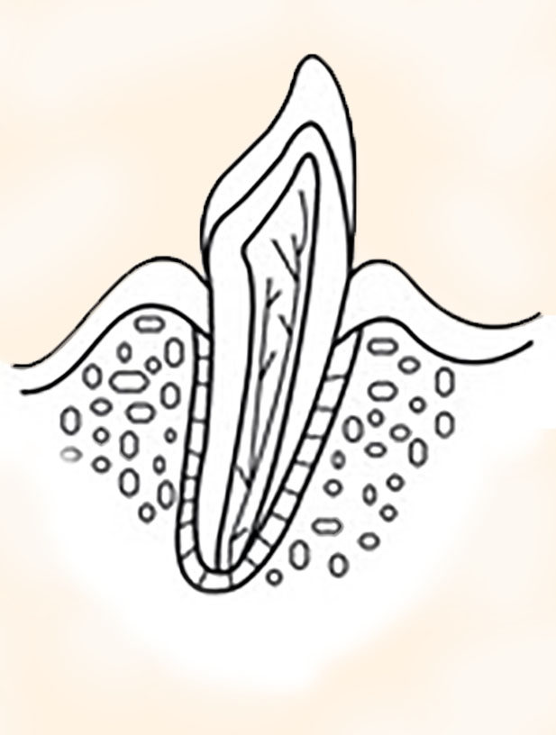 Zahnwurzel gesunder Zahn Endodontie Wurzelbehandlung gesunder Zahn