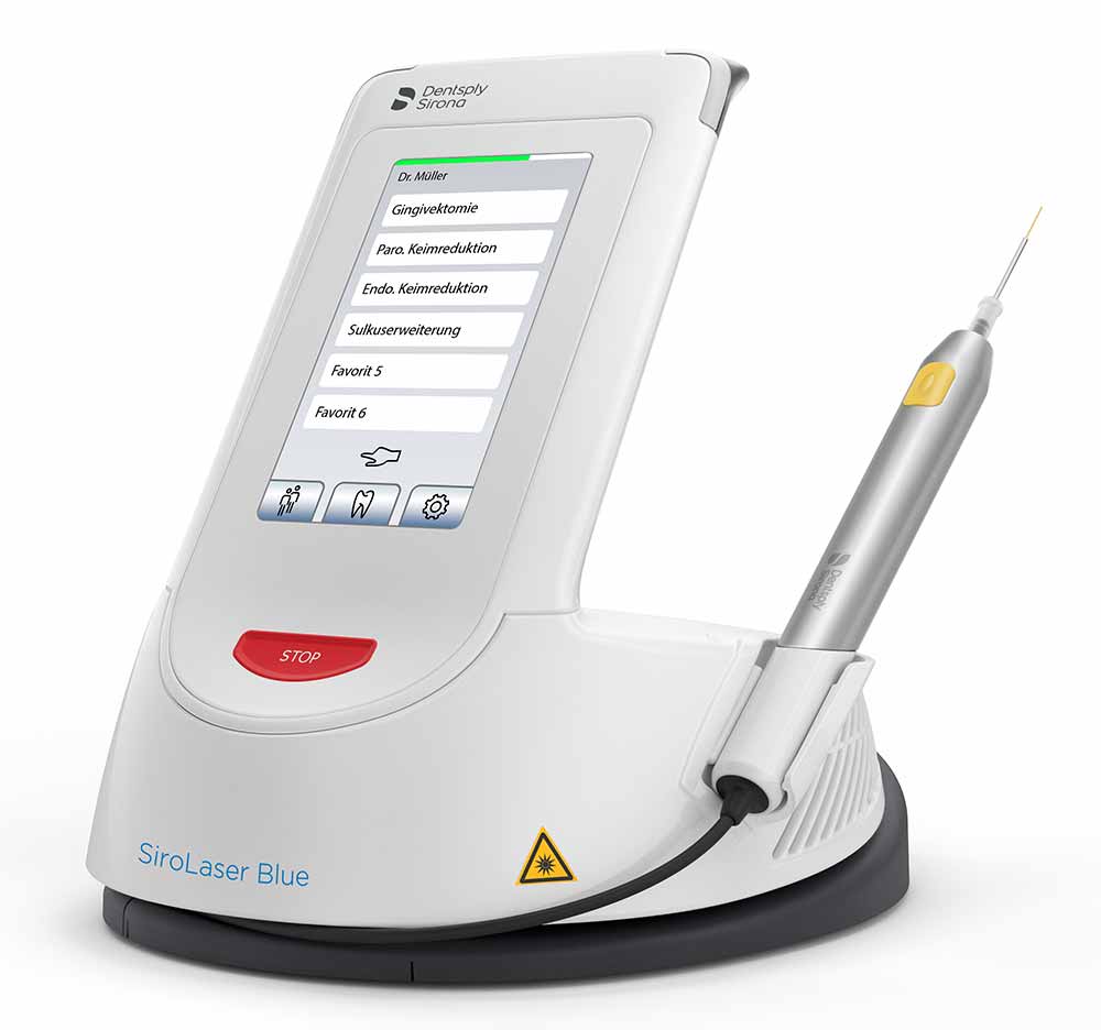 SiroLaser_Blue_2 Parodontologie Moderner Dentallaser - minimalinvasiv